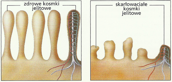 kosmki jelitowe